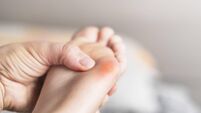 Close up of calluses. Problem skin on the steps of a teenager
